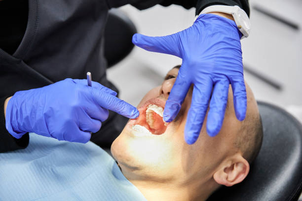 Best Chipped Tooth Repair Near Me  in Twin Lakes, NM